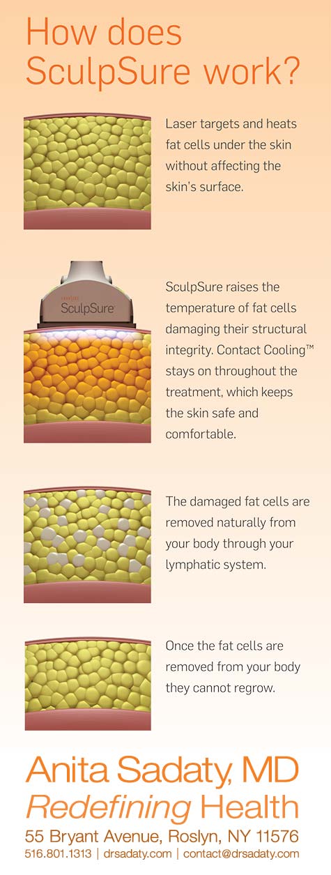 How does Sculpsure work for Dr. Sadaty's patients in New York