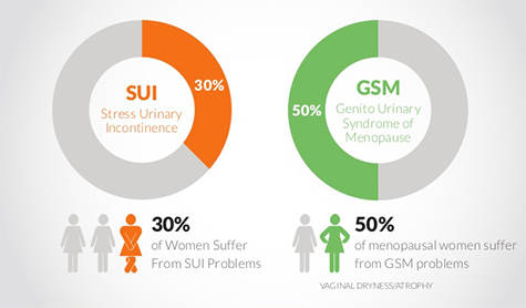 stress urinary incontinence stats