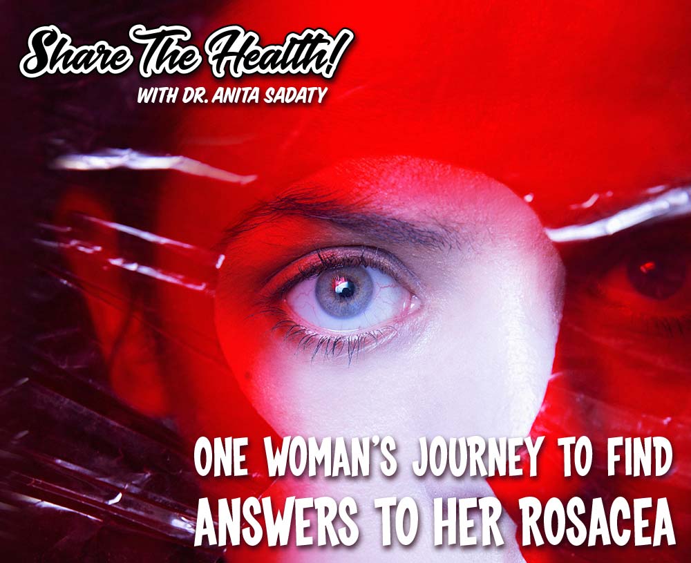 One Woman’s Journey To Find Answers to her Rosacea